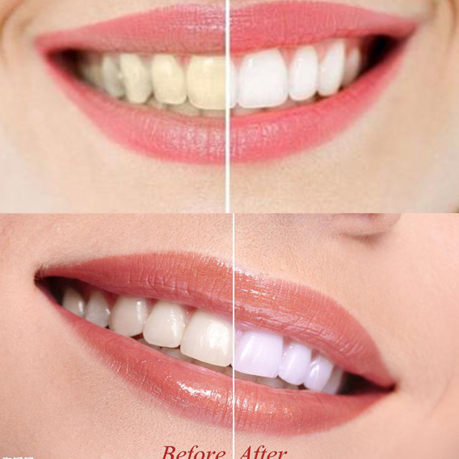 Dentes de carvão vegetal de ba - Teeth Whitening Charcoal Powder avaliação e preço