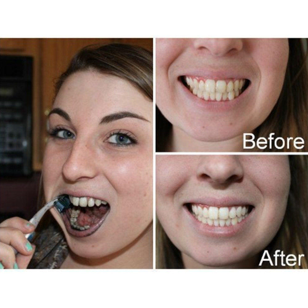 Dentes de carvão vegetal de ba - Teeth Whitening Charcoal Powder avaliação e preço
