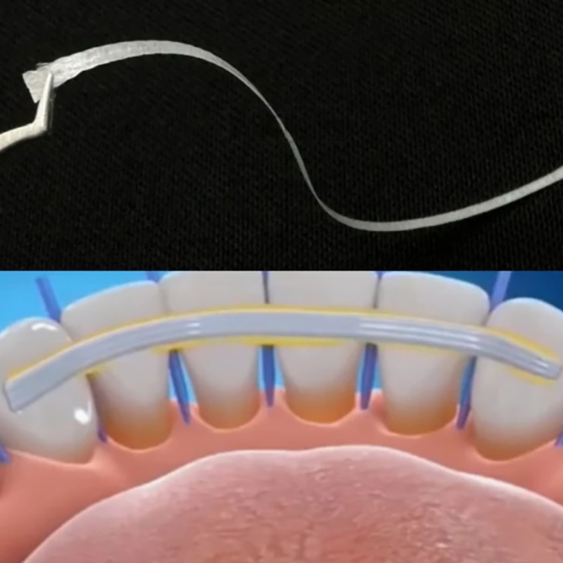 1/5 Peças Tiras de Fixação de  - Teeth Whitening Strips Lumineux avaliação e preço