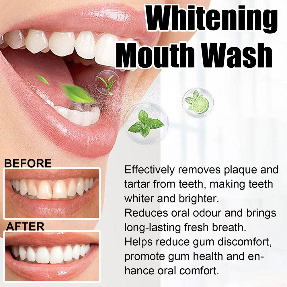 Enxaguante Bucal de Óleo de Co - Teeth Whitening Oil Pulling avaliação e preço