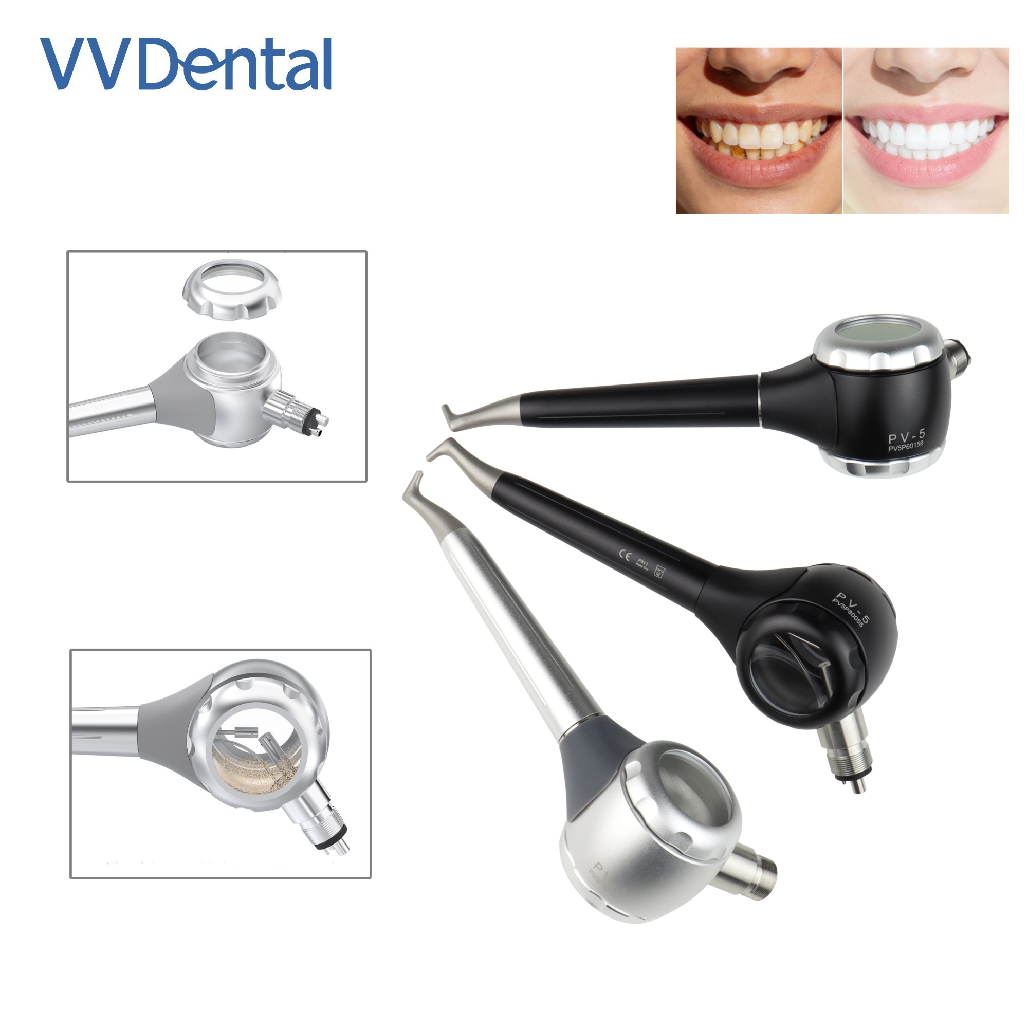 Pistola de Jateamento Dental V - Teeth Whitening China avaliação e preço