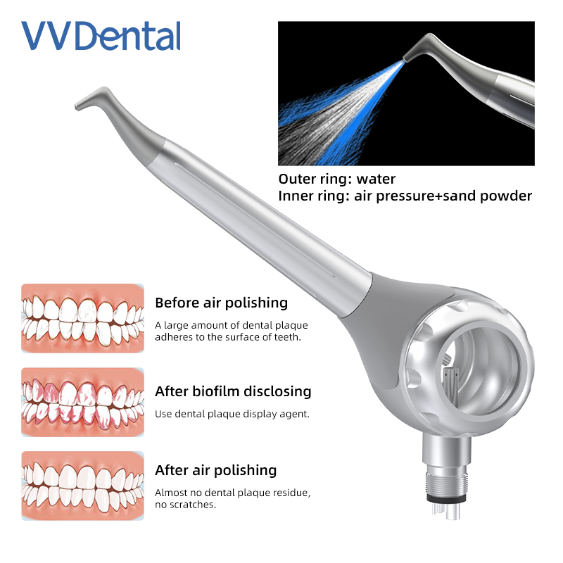 Pistola de Jateamento Dental V - Teeth Whitening China avaliação e preço