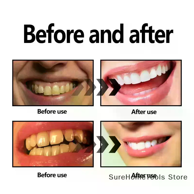 Pó de carvão de bambu para den - Teeth Whitening Charcoal Powder avaliação e preço