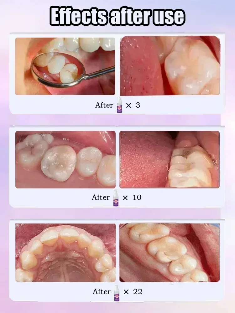 Reparação de Cáries, Proteção  - Teeth Whitening Charcoal Powder avaliação e preço