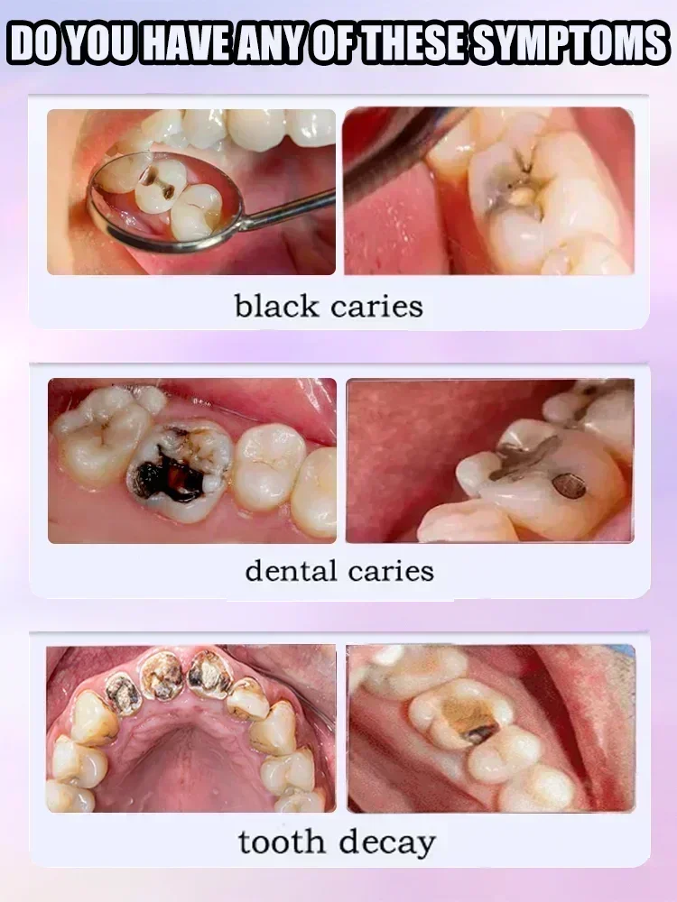 Reparação de Cáries, Proteção  - Teeth Whitening Charcoal Powder avaliação e preço