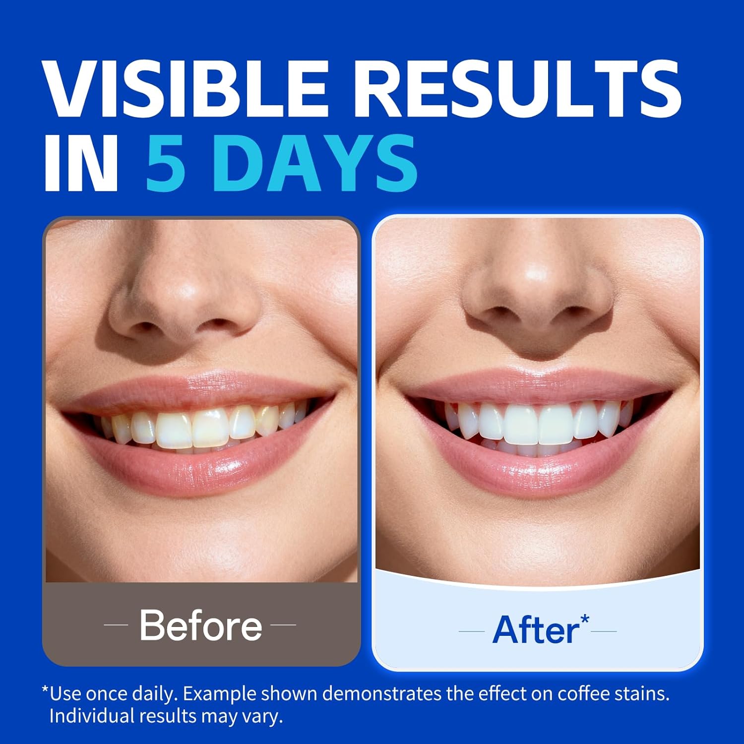 1/7 Pares de Fitas Clareadoras - Teeth Whitening Strips Crest avaliação e preço