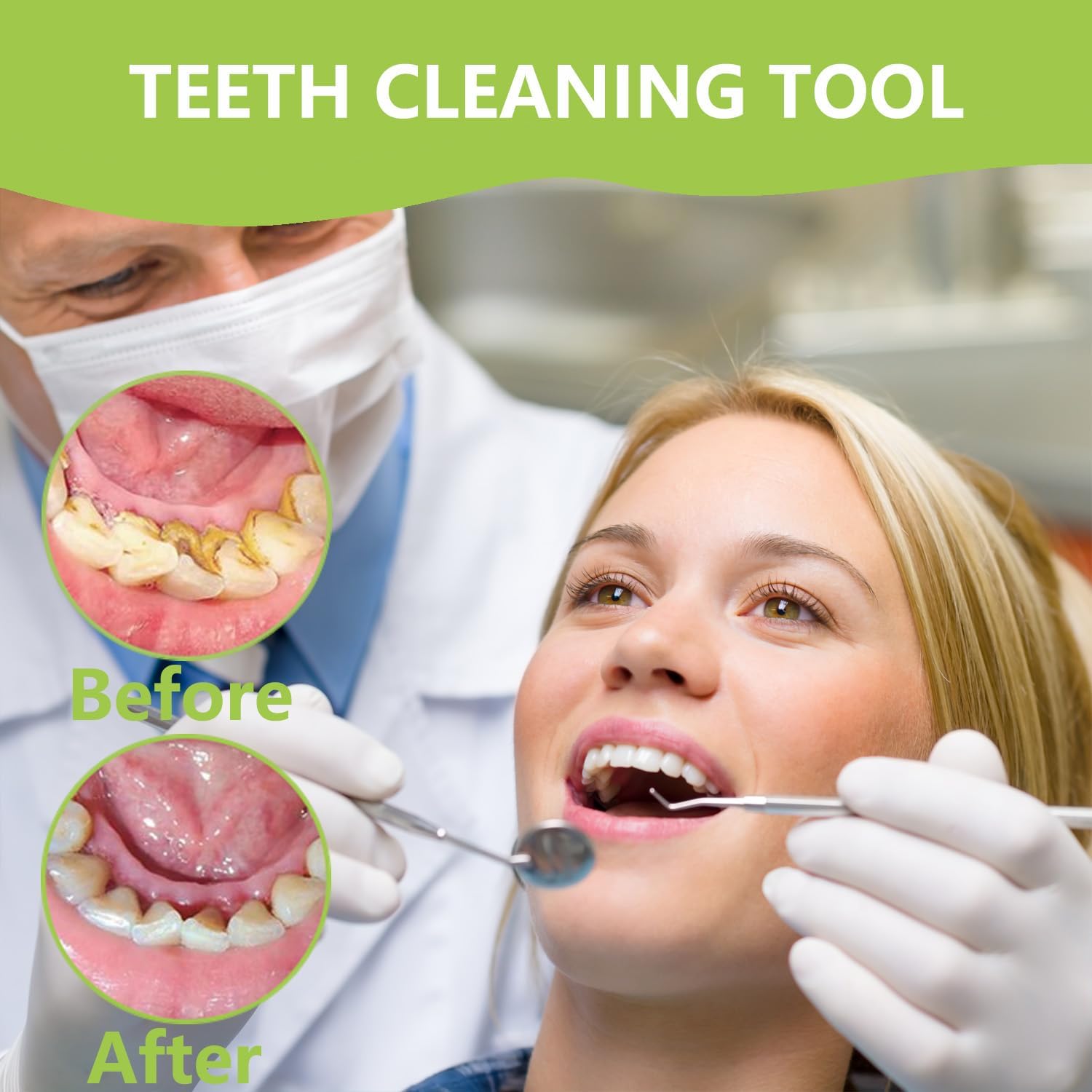 Kit profissional de higiene pa - Teeth Whitening Machine Professional avaliação e preço