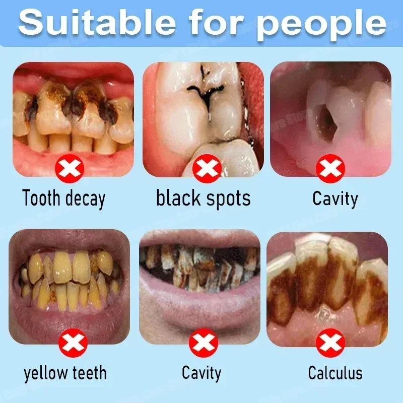 Pasta de Dente Anticáries: Rep - Teeth Whitening Uv avaliação e preço