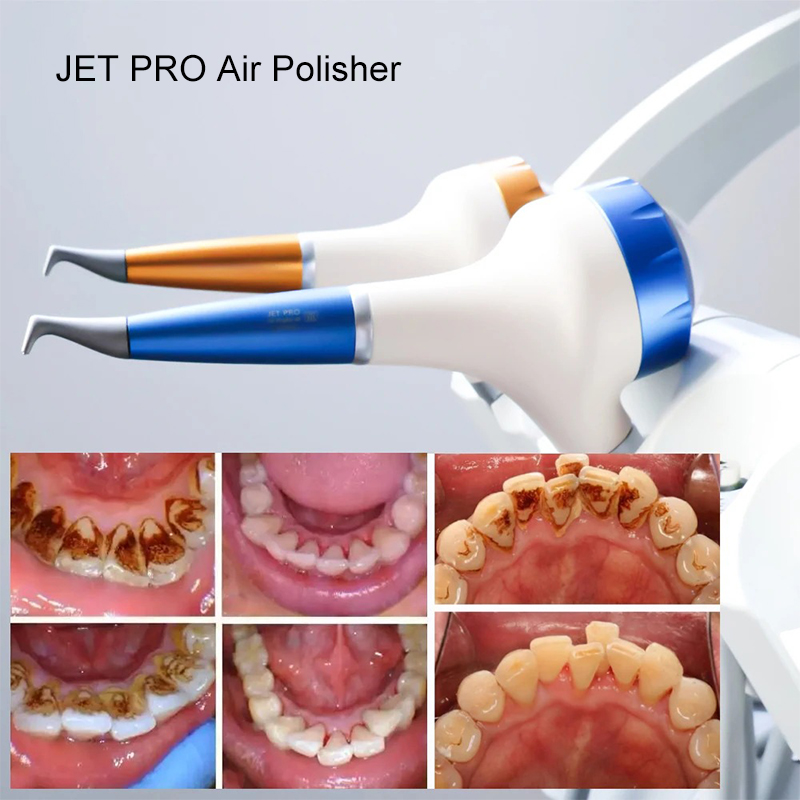 VV Dental Air Polishing Prophy - Teeth Whitening China avaliação e preço